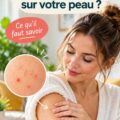 Illustration de points rouges sur la peau, symbolisant divers problèmes dermatologiques, en rapport avec la reconnaissance et le soin de la peau.